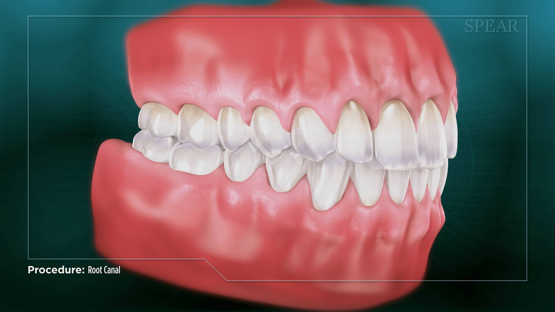 Complete Teeth Restoration at Lifetime Dentistry